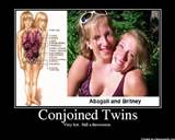 Hot Conjoined Twins Porn