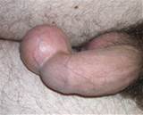 docking : I put a billard ball into my foreskin - DSCN0136.JPG